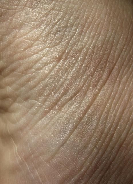 Fine Lines and Wrinkles | تجاعيد